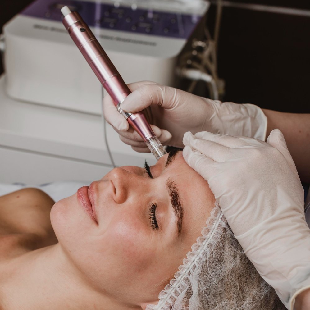 Cold plasma skin treatment